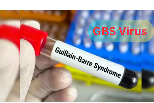 GBS Virus: Causes, Triggers & What You Need to Know